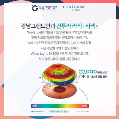 난시 각막 손상 증상 어떤 시력 교정 수술을? 사진 4