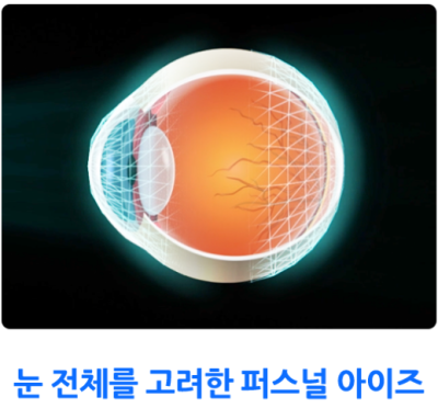 퍼스널아이즈,기존 시력교정과 어떤 차이점이 있을까요? 사진 2