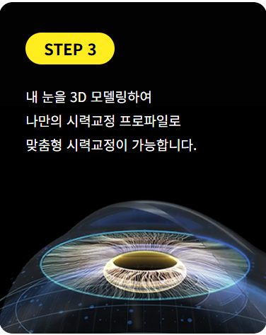강남그랜드안과, 퍼스널 라식라섹1,000례 달성 사진 4