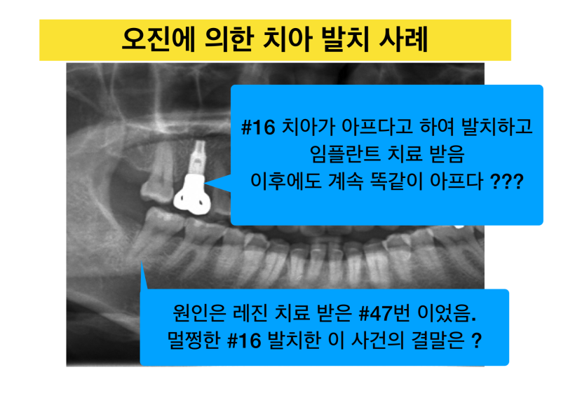 [치과 의료사고/치과오진의 비극] 치과치료후에도 계속 아프다면? 치아치료의 핵심은 진단이다 사진 2