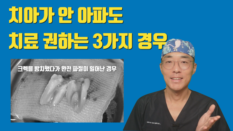 안타까워서 포스팅하는 통증이 없다고 치아 방치하면 안되는 경우 3가지