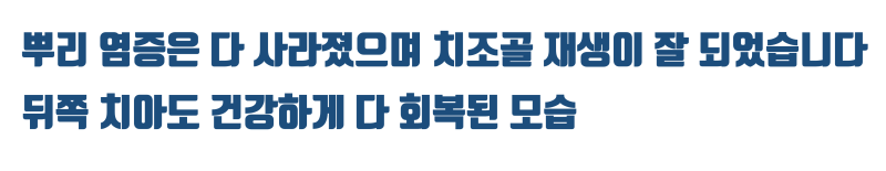 [어렵지만 보람있는 치근단수술] 옆 치아까지 번진 염증 치아의 치근단 수술 해결 #치근단수술 #치근절제술 #최용훈원장 사진 5