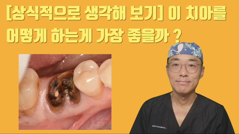 [일반인이 잘 모르는 치아 이식] 사랑니 이식이 가능한지 확인해보고 임플란트 결정이 낫습니다 #사랑니이식 #치아이식 #최용훈원장
