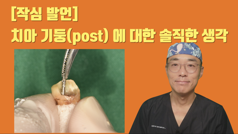 [솔직한 생각] 치아 기둥(Post) 세우기 전에 한 번 생각해 보세요 #치아살리기 #최용훈원장