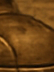 강남울쎄라 후기에 관하여 사진 7
