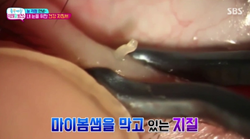 눈기름샘 청소 언제, 어떻게 해야할까?