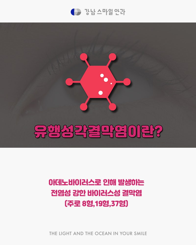 강남역 눈병 치료 받으려면 여기부터 가보자