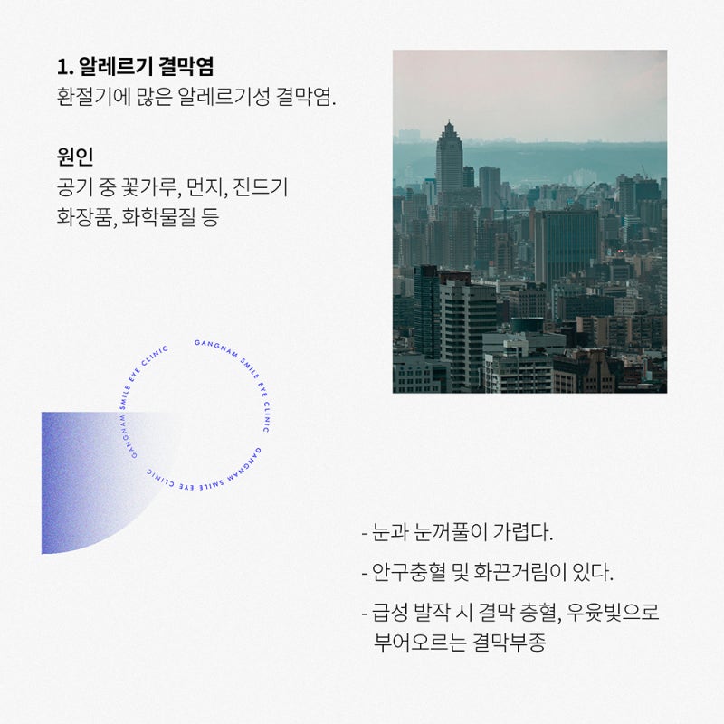 우리들이 겪을 수도 있는 결막염 ! 안질환관리도 안과에서 체크!!