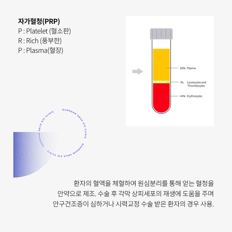 라식,라섹 수술 시 자가혈청, 그게 뭐길래??