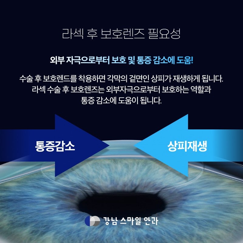 LASIK術後佩戴保護鏡片的原因與建議佩戴期間