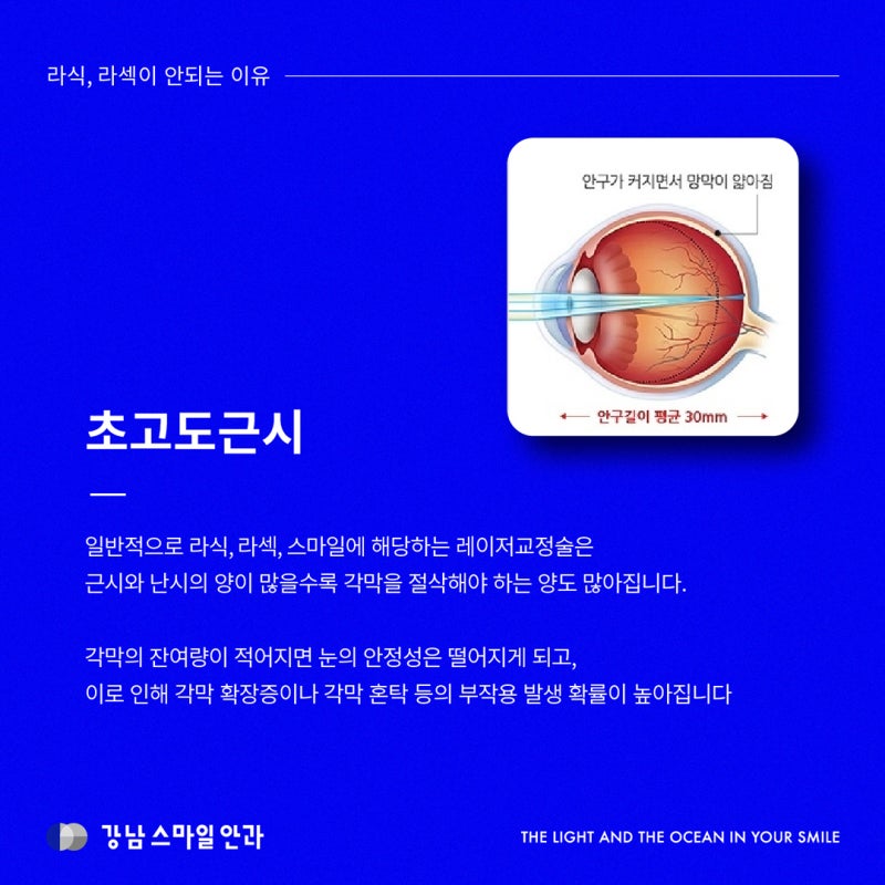 Apakah mata saya tidak bisa menjalani LASIK atau LASEK? Kasus yang tidak memungkinkan dan solusinya