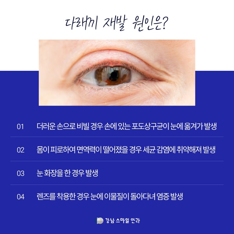 Recurrent Styes: Is ‘This’ the Cause? Watch Your Diet Too!