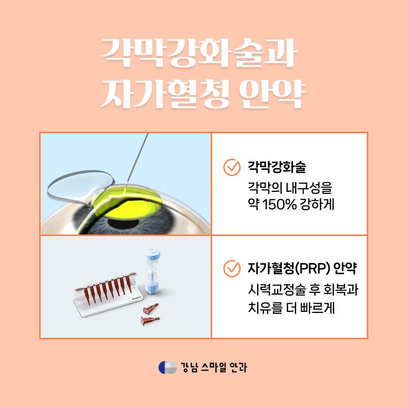 How Far Have Technologies for Reducing Pain After LASEK Come? Seocho-dong Ophthalmology