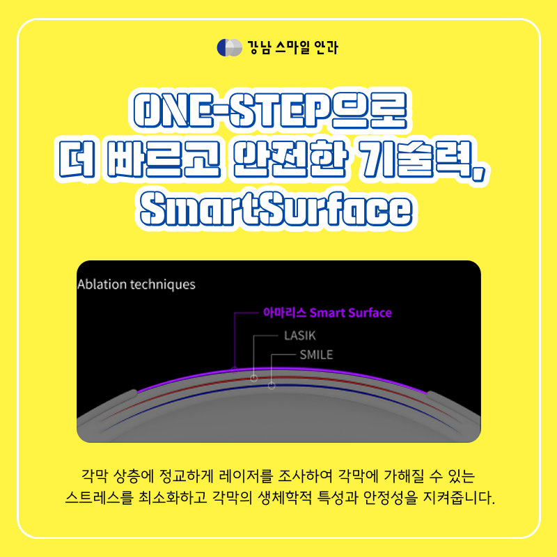 Gangnam Station Today LASEK with Fast Recovery: What are SmartSurface & SPT Technologies?