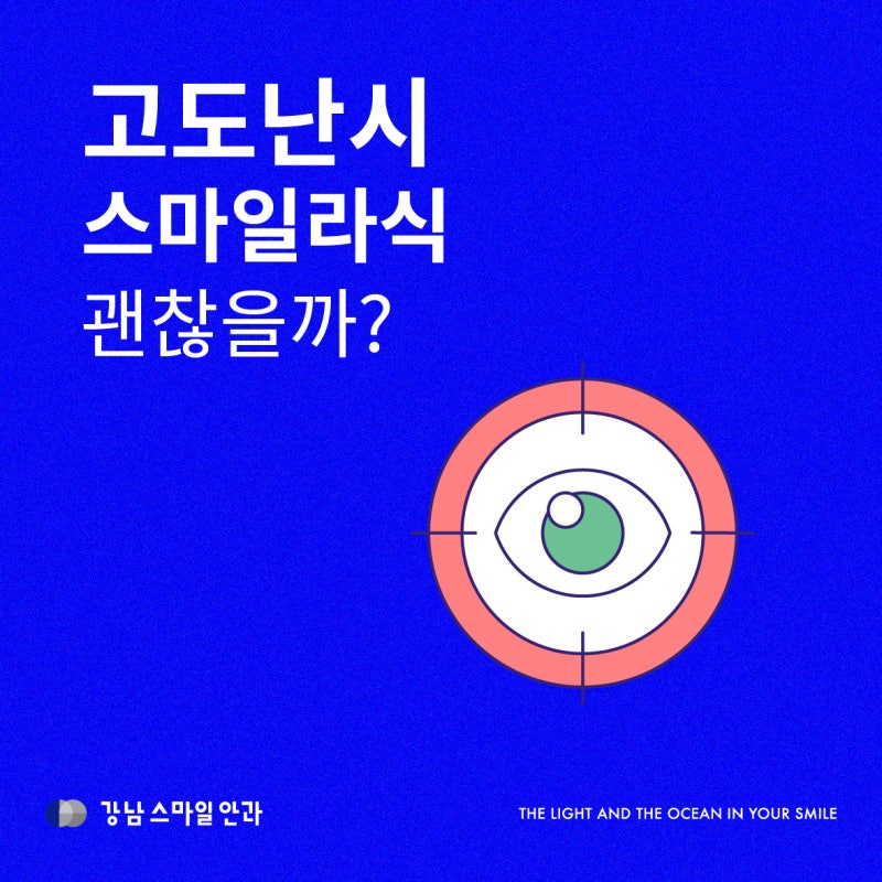고도난시스마일라식, 정말 가능할까? 수술 전 확인해야할 기준