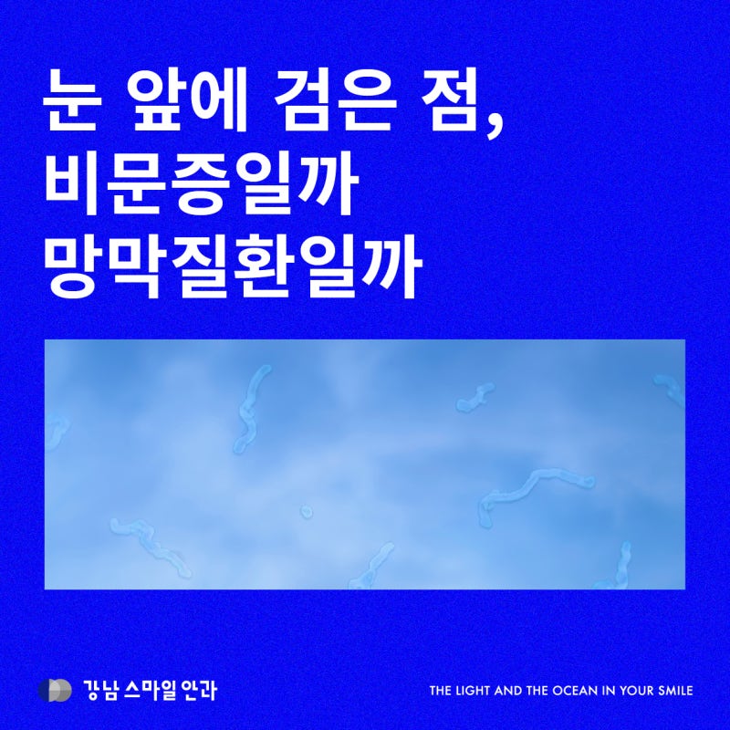 눈 앞에 검은점이 보인다면? 비문증일까 망막질환일까