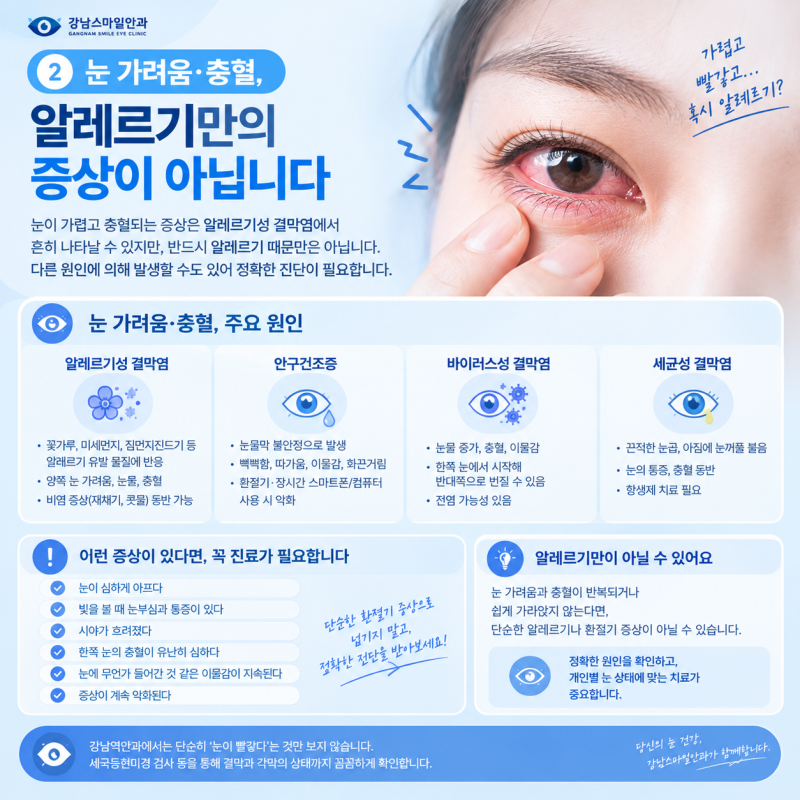 강남역안과 | 눈가려움 충혈, 환절기 때문이라고 그냥 넘겨도 될까? 사진 3