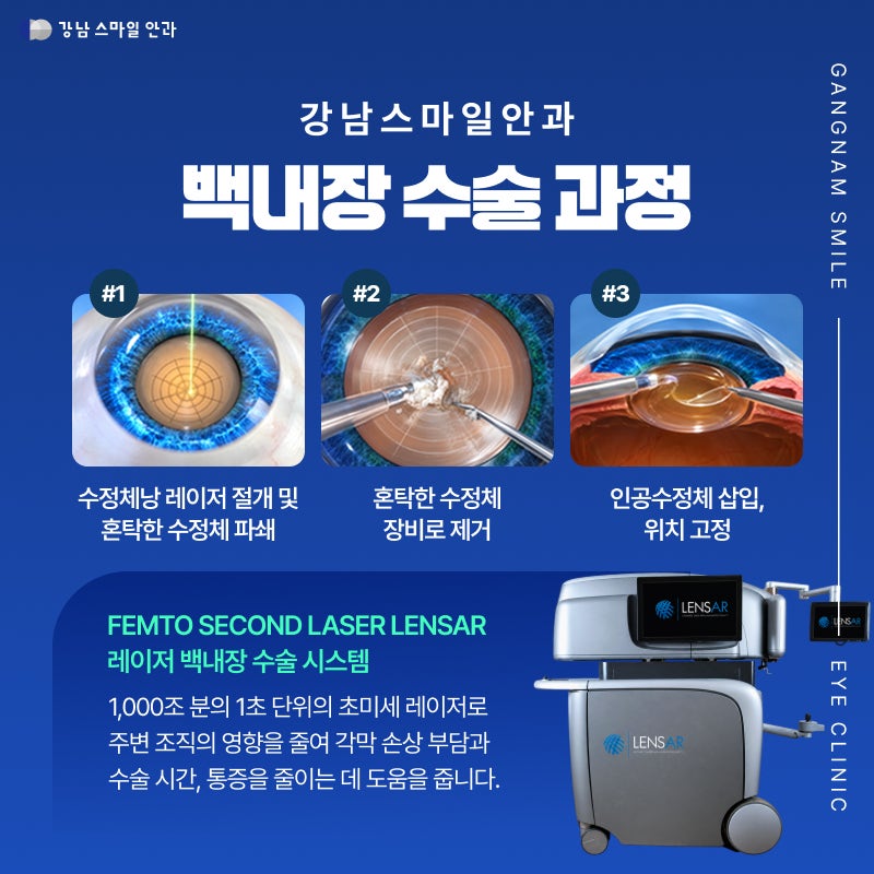 강남백내장수술 회복기간, 수술 다음날부터 일상생활 가능?