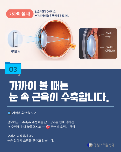강남백내장수술 전 알아두면 좋은, 눈의 자동 초점 원리 사진 5