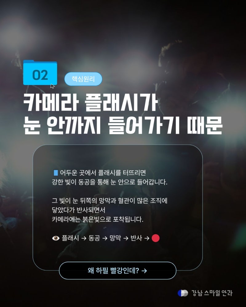 [강남역안과] 사진 찍으면 왜 눈이 빨갛게 나올까? 적목현상의 원리와 주의할 점 사진 3