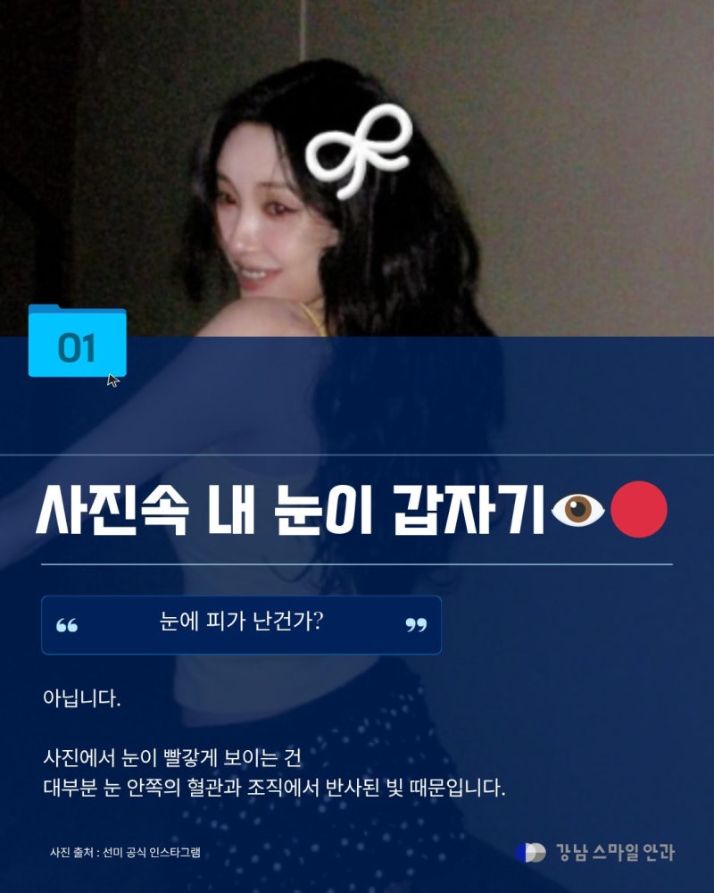 [강남역안과] 사진 찍으면 왜 눈이 빨갛게 나올까? 적목현상의 원리와 주의할 점 사진 2