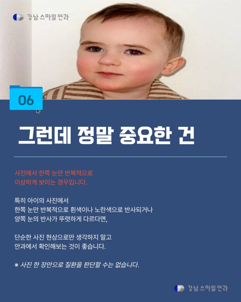 [강남역안과] 사진 찍으면 왜 눈이 빨갛게 나올까? 적목현상의 원리와 주의할 점 사진 7
