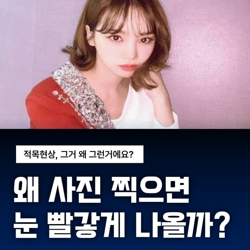[강남역안과] 사진 찍으면 왜 눈이 빨갛게 나올까? 적목현상의 원리와 주의할 점