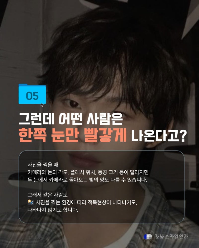 [강남역안과] 사진 찍으면 왜 눈이 빨갛게 나올까? 적목현상의 원리와 주의할 점 사진 6