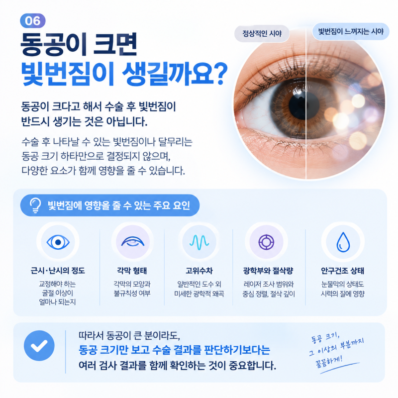 Gangnam Station 2-Day LASEK: 3 Essential Things to Know if You Have Large Pupils 사진 4