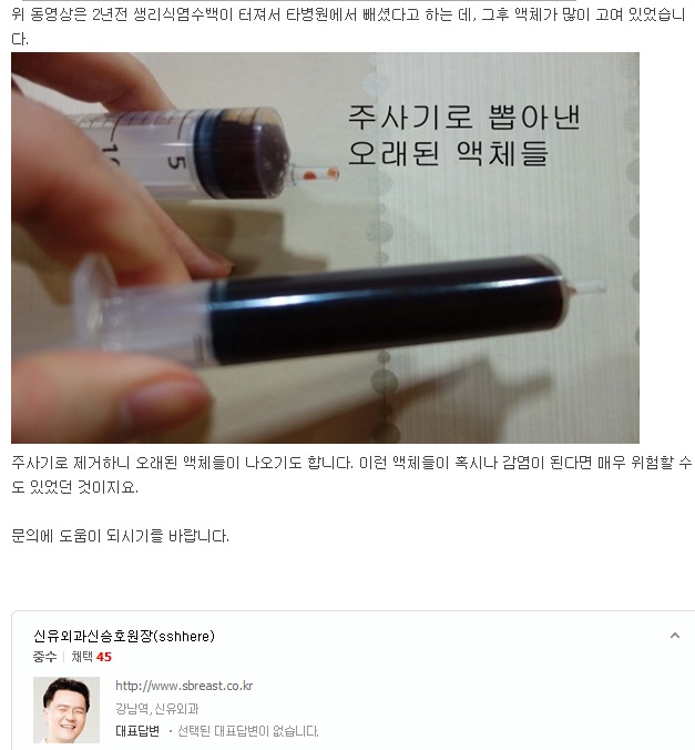 십년전 가슴성형후(가슴보형물파손제거수술)