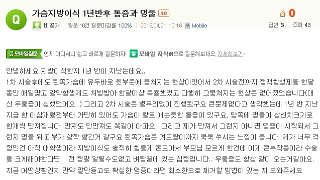 가슴지방이식 1년반후 통증과 멍울 ; 지방괴사석회화염증혹 부작용발생 치료 어찌해야 할 지