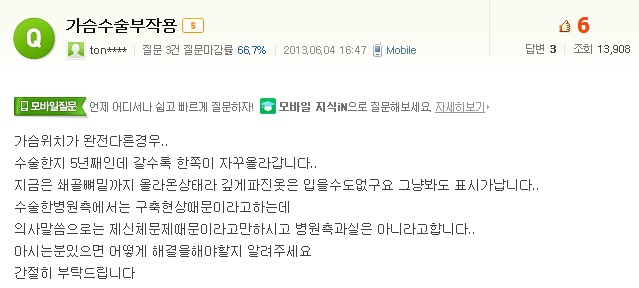 가슴수술부작용 : 한쪽 가슴이 자꾸 올라가요. 구형구축인가요