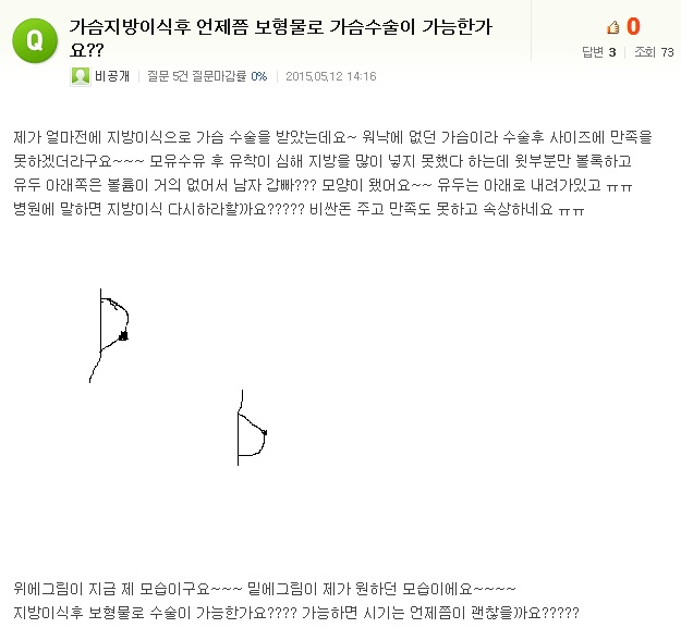 가슴자가지방이식수술후 언제쯤 보형물로 가슴성형수술이 가능한가요??