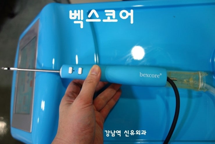 강남역 유방외과전문의가 쓰는, 또 다른 맘모톰, 벡스코어(Bexcore) 사용 후기. 