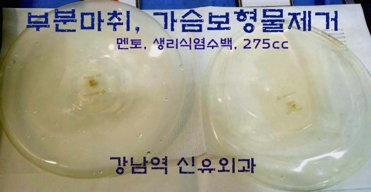 가슴보형물제거와 보형물맘모톰수술을 동시에 시행받으신 수술후기