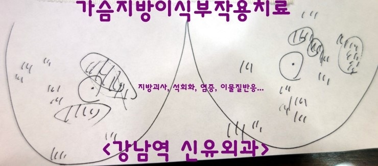 줄기세포자가지방이식수술부작용치료후기 (근육속에 병변이 처박힌 양상, 그동안 정신적으로 고생많이 하신 분 ㅠㅠ)