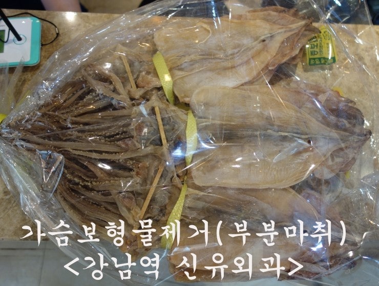 강원도에서 배달 온 오징어들~~ ^^ 