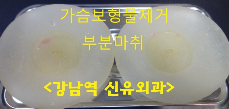 가슴보형물제거수술후기 : 생리식염수백 유착이 정말 심했던 분. 