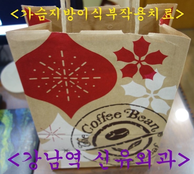 가슴지방이식부작용치료후기 [지방괴사, 만성염증, 염증세포침윤 등 전형적인 소견 나온 분]