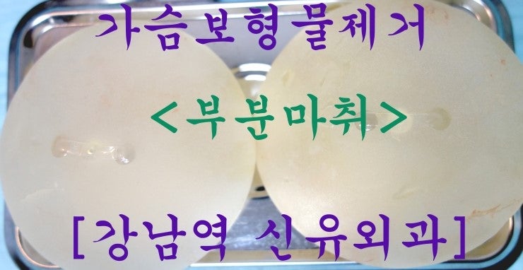 가슴보형물파손후 제거수술후기