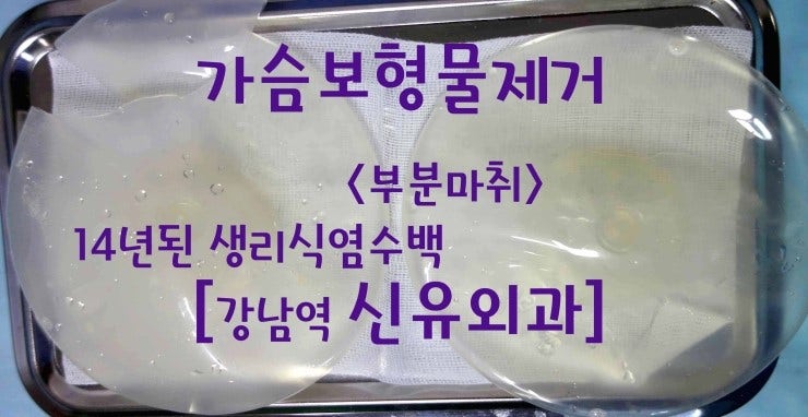 가슴보형물제거수술후기 : 세빈 스무스 생리식염수백 175cc. 