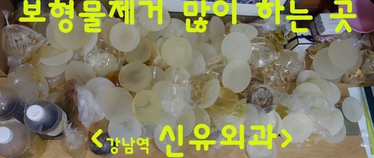 출산후처진가슴(유방하수) 거상리프팅 & 보형물제거(225cc) ; 후기 ; 부분마취