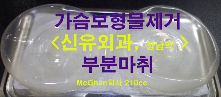 배꼽 생리식염수백가슴성형보형물파손되어 부분마취로 제거