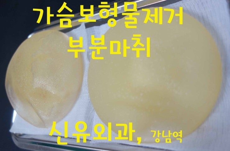 20여년전 가슴성형하셨던 분의 보형물제거수술후기 