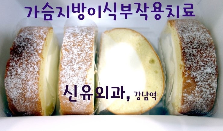 10년만에 가슴지방이식성형수술부작용 석회화고름집염증 생기셔서 오신 분 치료.