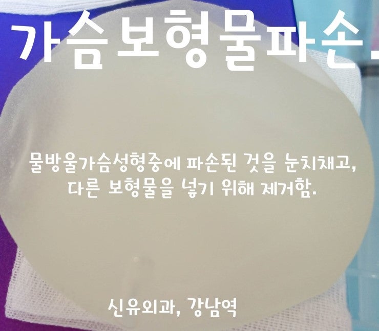 임신출산수유후 처진가슴 물방울보형물거상술 중에 파손 발견하여 제거, 교체한 증례