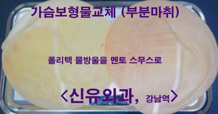 부분마취로 폴리텍 물방울을 멘토 스무스로 교체받으시고 바로 목포 내려가신 분의 후기