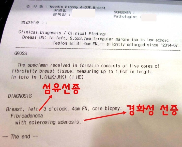 인도네시아에서 오신 맘모톰수술후기