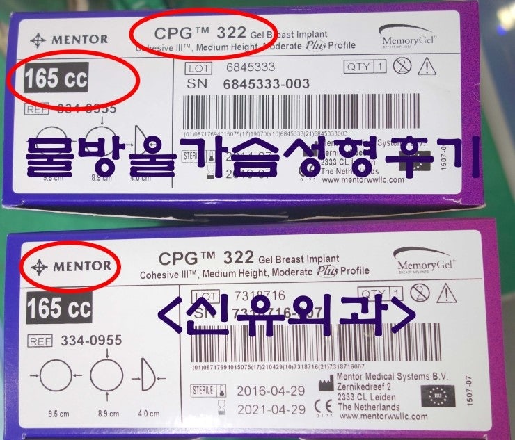 물방울보형물 165cc 가슴성형수술 후기