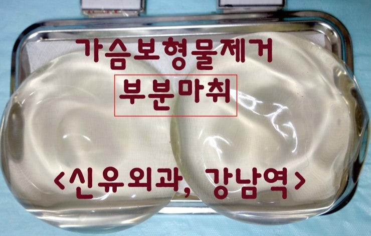 가슴보형물제거수술후기